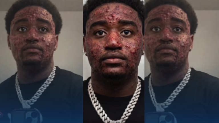 Man Tests Positive For 5 STIs After Vacation in Houston, USA